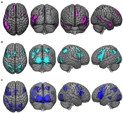 Paradoxical Reasoning: An fMRI Study